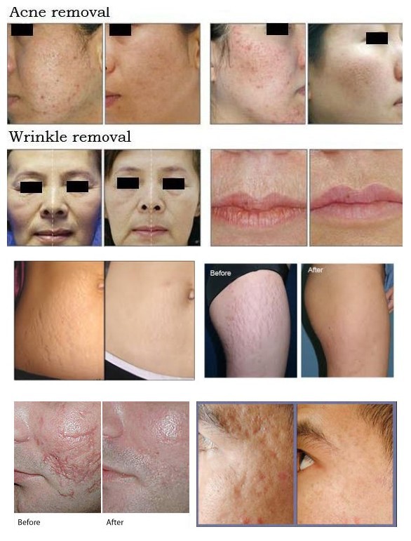 перед-после pics.jpg